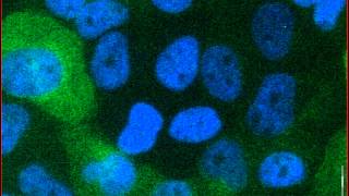 Mitotic catastrophe triggered in human cancer cells by the viral protein apoptin  movie A [upl. by Lednyc333]