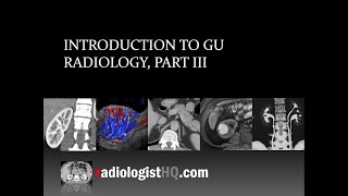 Introduction to Genitourinary Radiology Part III [upl. by Garretson443]