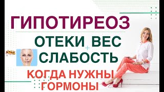 💊 СЛАБОСТЬ❓ ОТЕКИ❓ НАБОР ВЕСА❓ ГИПОТИРЕОЗ КОГДА ВВОДИТЬ ГОРМОНЫ❓ Врач эндокринолог Ольга Павлова [upl. by Annasus965]