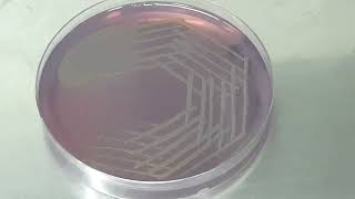 Stenotrophomonas maltophilia colony morphology on CLED agar [upl. by Nirehtac]