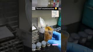 Stool💩 examination 🧐 [upl. by Gio]