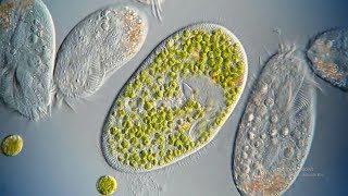 What are Ciliates [upl. by Forster18]