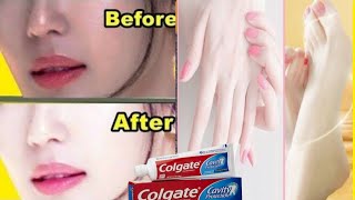 COLGATE TOOTHPASTE FOR FACE WHITENING  LEMON AND COLGATE [upl. by Statis832]