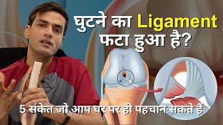 घुटने का Ligament फटा हुआ है 5 संकेत जो आप घर पर ही पहचान सकते हैं [upl. by Cima]