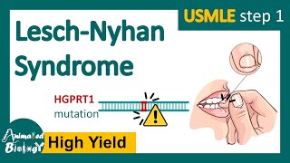 LeschNyhan syndrome  What are the symptoms of LeschNyhan syndrome  Treatment options  USMLE [upl. by Amalburga291]