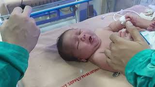 Neonatology1 Demonstration by Parvej Da [upl. by Eizzil]