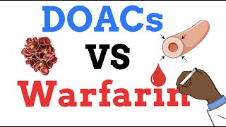 DOACs vs Warfarin  WHEN TO USE ONE vs THE OTHER [upl. by Dnomyad353]