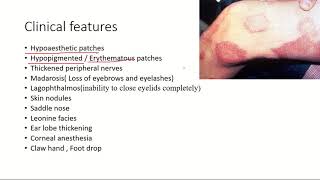 LeprosyHansens disease Pathogenesis Clinical features and treatment l USMLE [upl. by Ashlie]