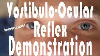 Caloric Testing COWS VestibuloOcular Reflex Hack  It Works [upl. by Micheal760]