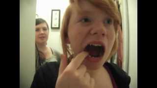 HOW TO Temporary Tooth Filling [upl. by Lenaj]