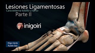 US EN LESIONES LIGAMENTOS EXTERNOS DEL TOBILLO PARTE II [upl. by Lleraj60]