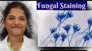 Fungal Staining Procedure। Lactophenol Cotton Blue staining  Staining Technique [upl. by Emery]