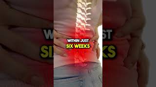 Can You Heal a Herniated Disc backpainrelief bobandbrad herniateddisc painrelief healthtips [upl. by Goto24]