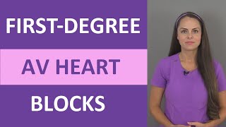 FirstDegree AV Heart Block Nursing NCLEX ACLS ECGEKG Prolonged PR Interval [upl. by Alabaster]