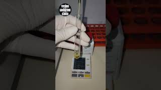 🫘Como Hacer la Determinación de UREANITRÓGENO UREICO en el Laboratorio ClínicoTutorial🔬P2 [upl. by Airdnahc]