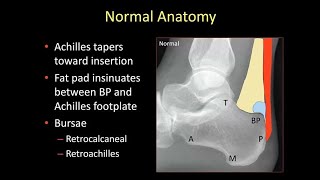 Emory MSK ELecture Series  Dr Hilary Umans [upl. by Francie436]