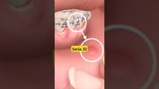 How to Use Wax for Dental Braces on shorts viral [upl. by Neo670]