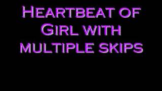 Heartbeat of 22 yoFemale Skipping Multiple Beats [upl. by Htiduj]