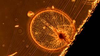 Noctiluca under the Microscope [upl. by Arevle]