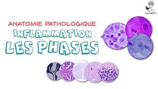 Anatomie Pathologique  Phases de lInflammation [upl. by Bausch901]