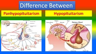 Difference Between Panhypopituitarism and Hypopituitarism [upl. by Burlie590]