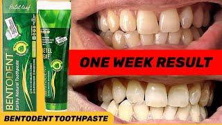 Bentodent natural toothpaste review bentodent toothpasteBentodent [upl. by Rimidalb947]