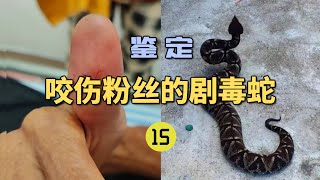 4K  鉴定咬伤粉丝的毒蛇（15）粉丝的父亲被五步蛇咬伤！出现严重凝血异常？指标都测不出来了！【世界记忆大师龙雅】 [upl. by Acinorehs828]