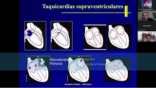 Video 3ra Clase Curso  Taller Electrocardiografía [upl. by Atteloc557]