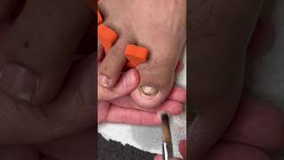 Toenail reconstruction tutorial 💅🏿 nails nailstutorial viralshorts2024 fypyoutube fypシ゚viral [upl. by Aniral]