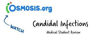 Candidal Infections Osmosis Study Video [upl. by Latoye]