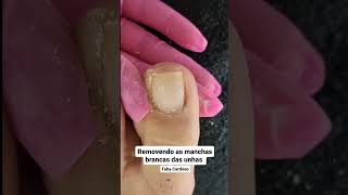 Como tirar manchas das unhas por Faby Cardoso [upl. by Cordova]