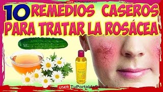 ROSÁCEA  10 REMEDIOS CASEROS Y NATURALES PARA LA ROSACEA [upl. by Nolrev]