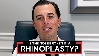 What is Osteotomy During Rhinoplasty Nose Job Surgery  Dr Anthony Corrado [upl. by Nekciv746]