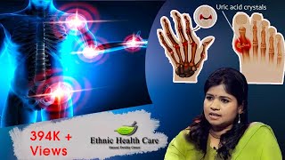 யூரிக் அமில அளவு குறைப்பது எப்படி  High Uric Acid  Mens Gout Arthritis  Dr Yoga Vidhya [upl. by Zirkle]