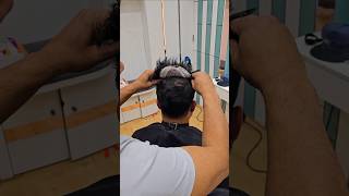 Clipping Hair Patch for Mens  Permanent Hair Patch Delhi hairpatch hairtranformation [upl. by Papst]