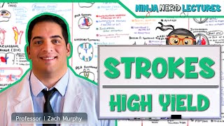 Ischemic and Hemorrhagic Strokes  High Yield [upl. by Sirap]