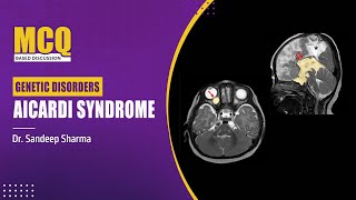 Genetic Disorders  Aicardi Syndrome by Dr Sandeep Sharma  PrepLadder Pediatrics NEET SS [upl. by Kola]