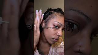 How I use Minoxidil 5 for my edges alopecia hairlosstreatment minoxidil hairlossmedication [upl. by Dukie441]