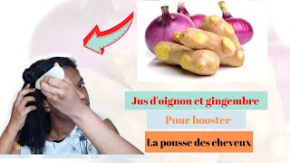 JUS DOIGNON ET GINGEMBRE POUR BOOSTER LA POUSSE DES CHEVEUX😱😱 [upl. by Eyoj]