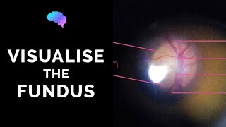 Fundoscopy  How to Visualise the Fundus  Direct Ophthalmoscopy  OSCE Guide  UKMLA  CPSA [upl. by Lambard]