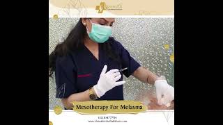 Mesotherapy For Melasma by Skinsmith [upl. by Sew43]