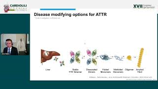 New pharmacological targets in amyloidosis cardiomyopathy What is the future  José Nativi [upl. by Trebled120]