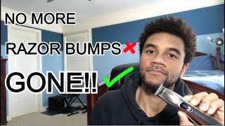 How To PREVENT RAZOR BUMPS  Get Rid of Razor Bumps amp Ingrown Hairs [upl. by Yorgerg883]