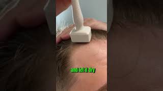 This Is How I Use My Derma Stamp To Increase My Hair Growth [upl. by Aivato]