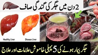 How to Cleanse Your Liver amp Jigar Ki Safai Ka Tarika [upl. by Ardek806]