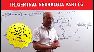 Trigeminal Neuralgia  Causes and Treatment  Part 3 [upl. by Arrakat]