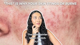 Signs of Damaged Skin Barrier Youre Probably Ignoring [upl. by Niattirb]