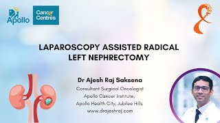 LAPAROSCOPIC LEFT RADICAL NEPHRECTOMY  KIDNEY CANCER  DR AJESH RAJ SAKSENA [upl. by Yenoh]