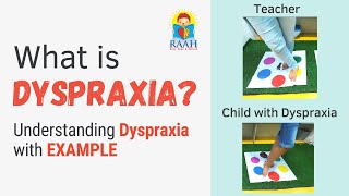 What is DYSPRAXIA   Signs amp Symptoms Explained with Examples  Developmental Coordination Disorder [upl. by Nolur]