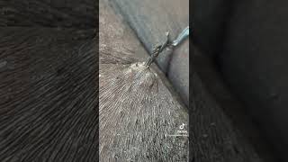 MASSIVE INGROWN HAIR ingrownhair extractionsatisfaciton ingrownhairremoval pimplepopping [upl. by Hieronymus]